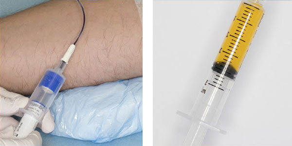 tratamientos biologicos